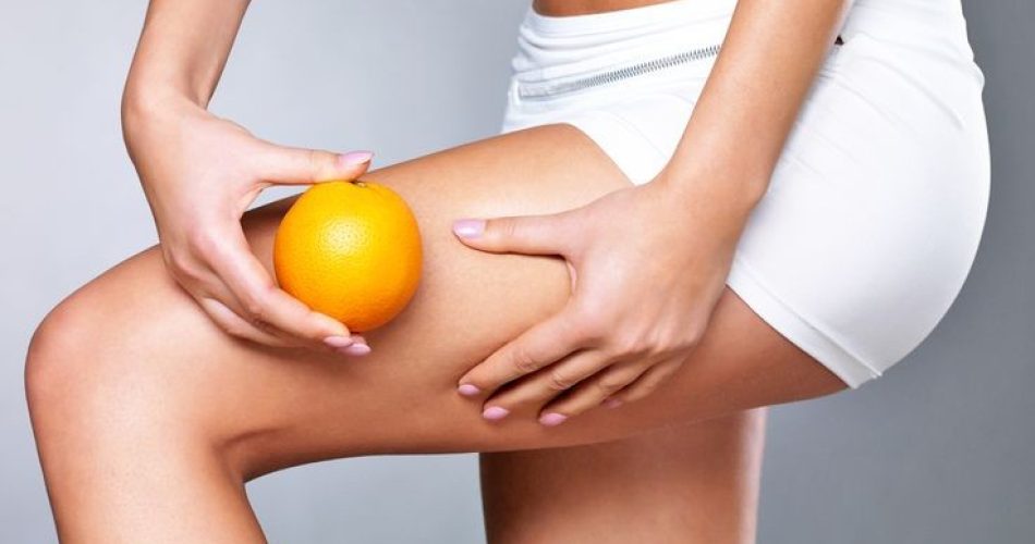 onde d'urto cellulite