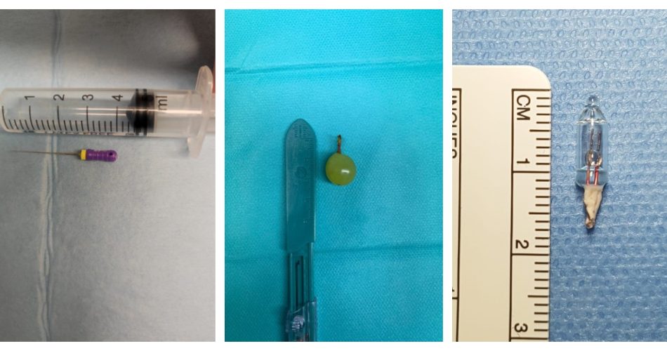 corpi estranei inalati o ingoiati policlinico