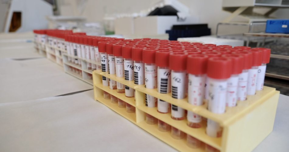 Lab Covid Di Venere (12) coronavirus coronavirus tamponi