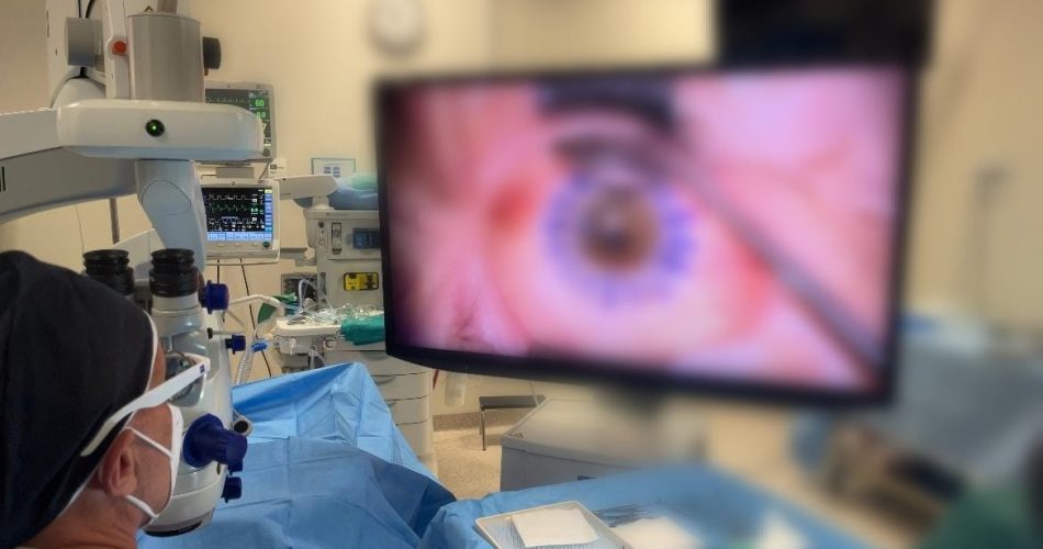 Trapianto di cornea - Oculistica Putignano (2)