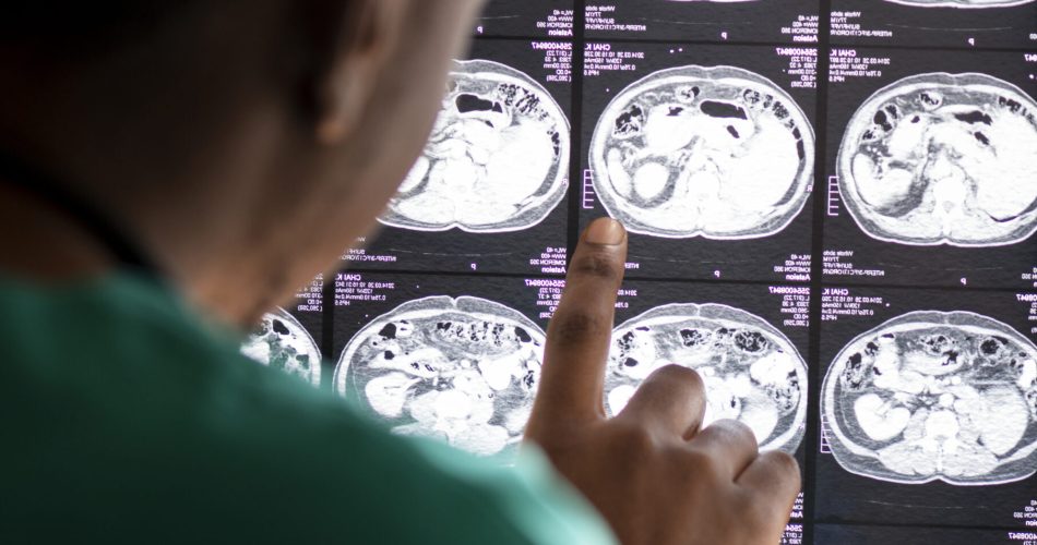 Doctor reading brain MRI x-ray result