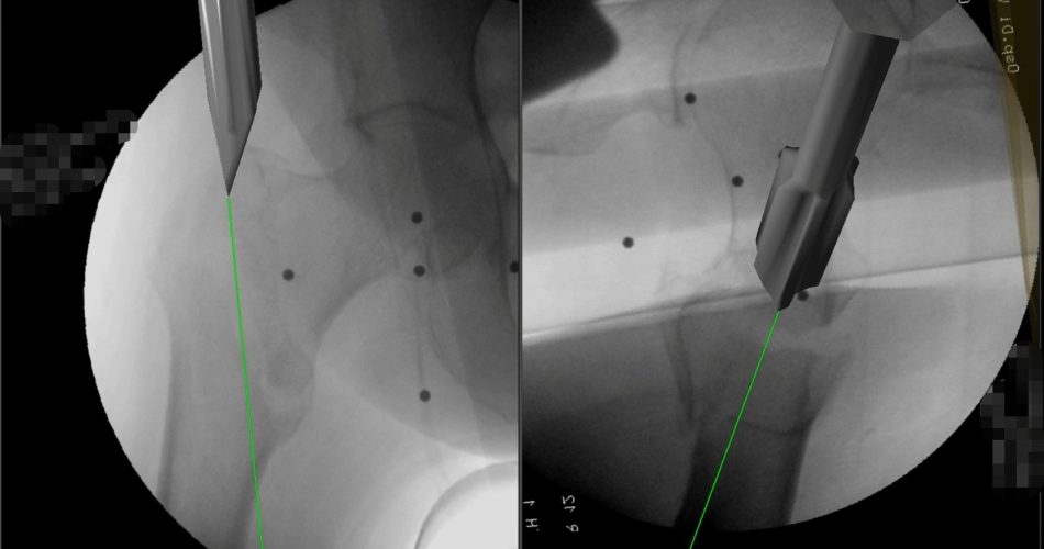 foto intraoperatoria realtà virtuale (4)