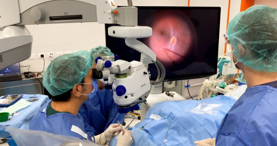 intervento oculistica policlinico