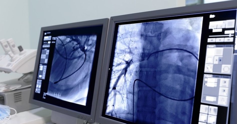 Monitor screen in radiology. (foto Ansa)