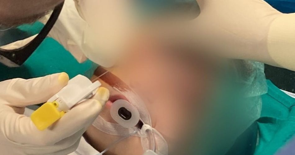 radiologia bambini policlinico