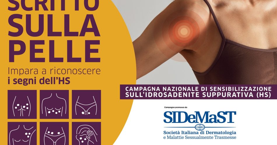 scritto sulla pelle SIDEMAST